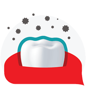 Sprečavanje karijesa